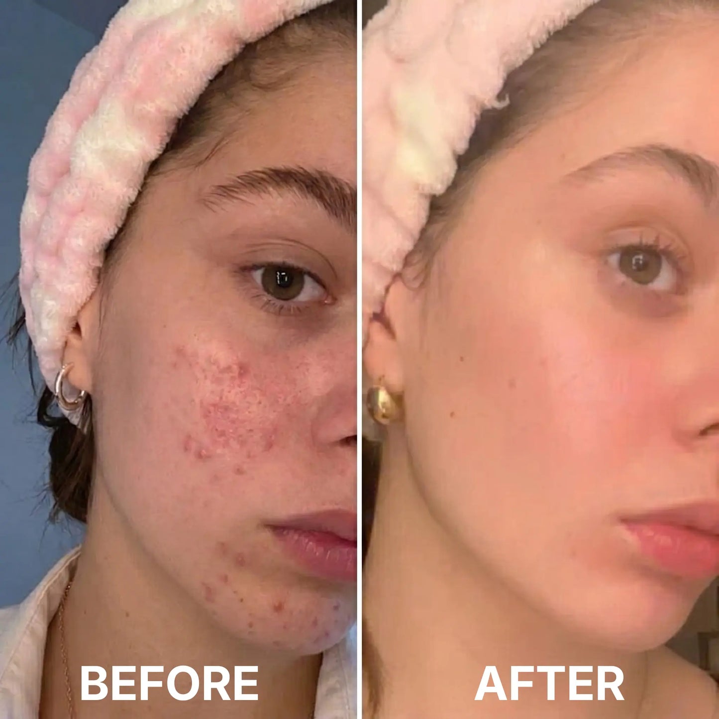 JiYu Renewal & Rejuvenation Toner Pads