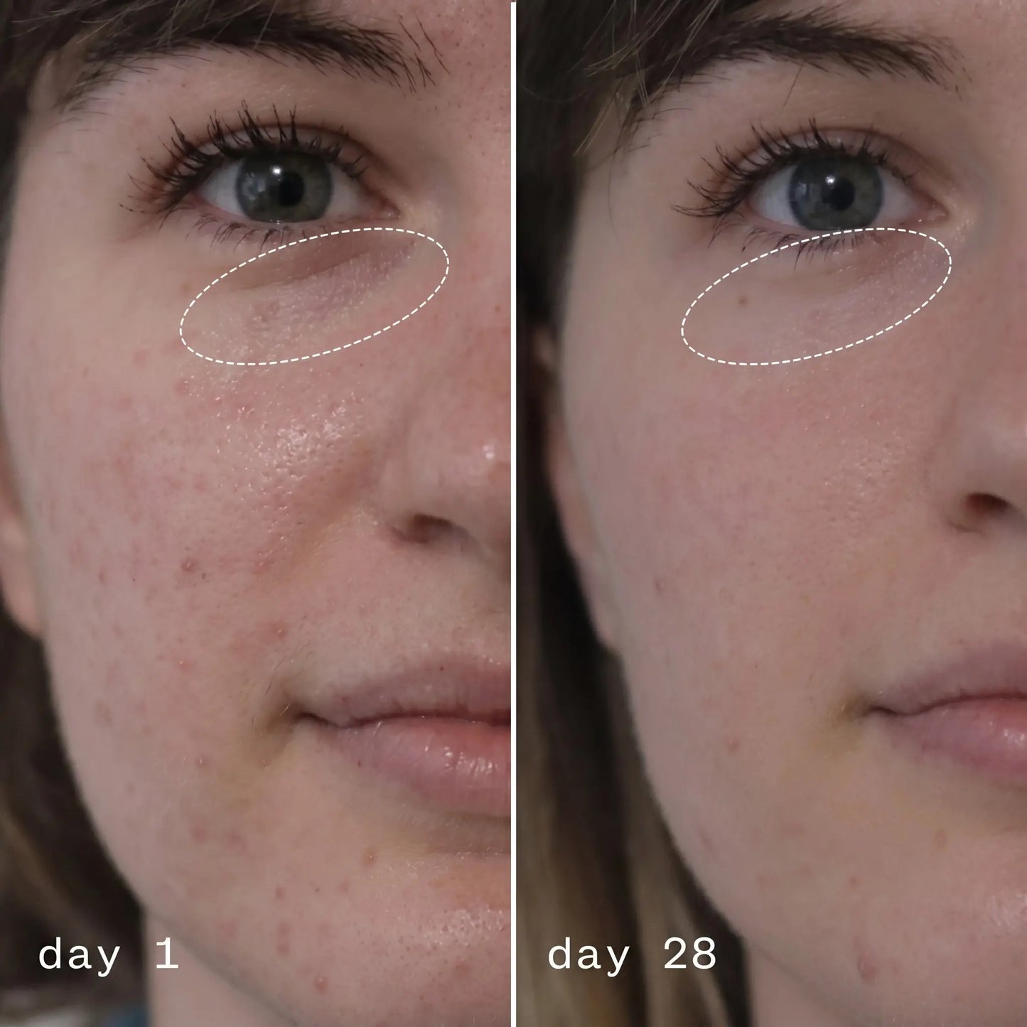 JiYu Anti-Aging Moisturizing Cream