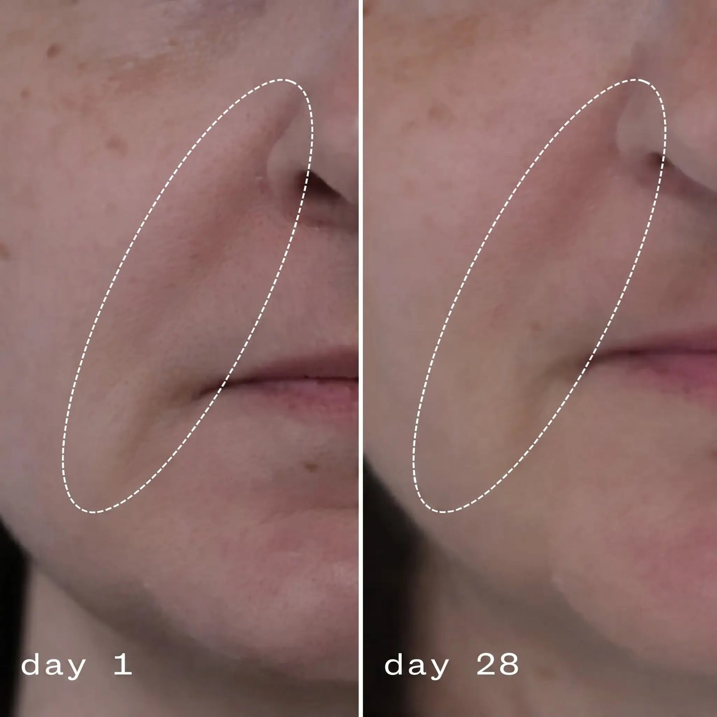 JiYu Anti-Aging Moisturizing Cream